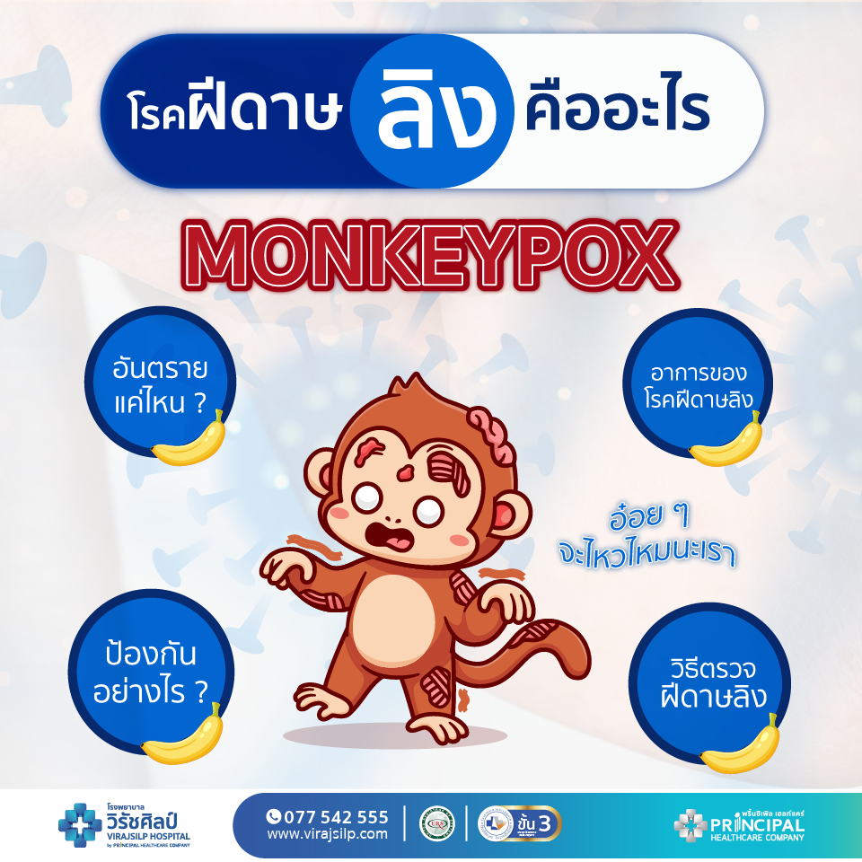 โรคฝีดาษลิงคืออะไร รู้ไว้ปลอดภัยกว่า