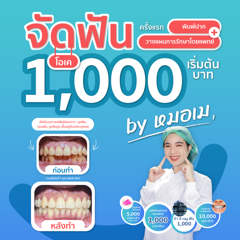 จัดฟัน ที่โรงพยาบาลวิรัชศิลป์ เริ่มต้นที่ 1,000 บาท