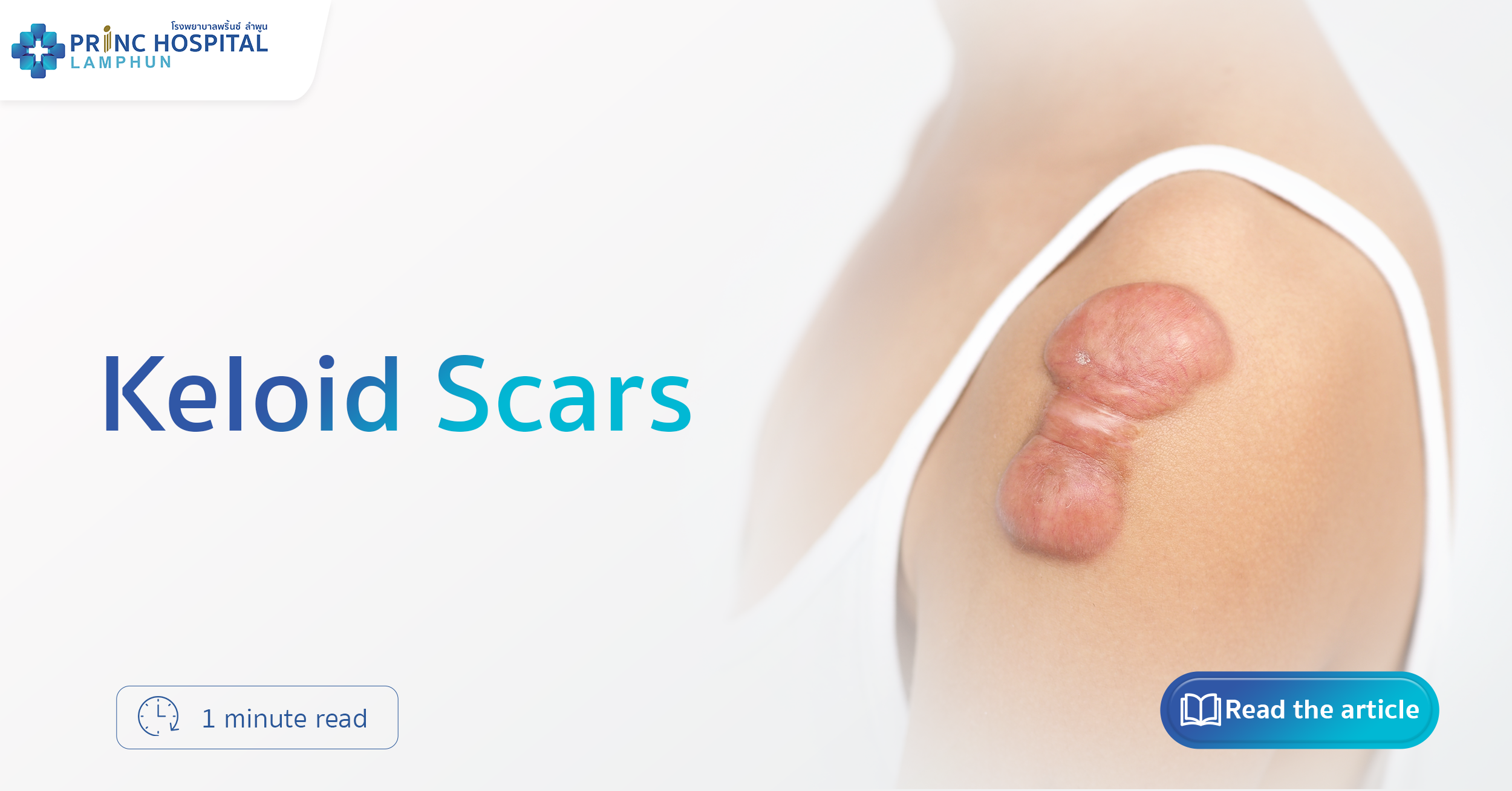 Keloid Scars | Princ Hospital Lamphun 