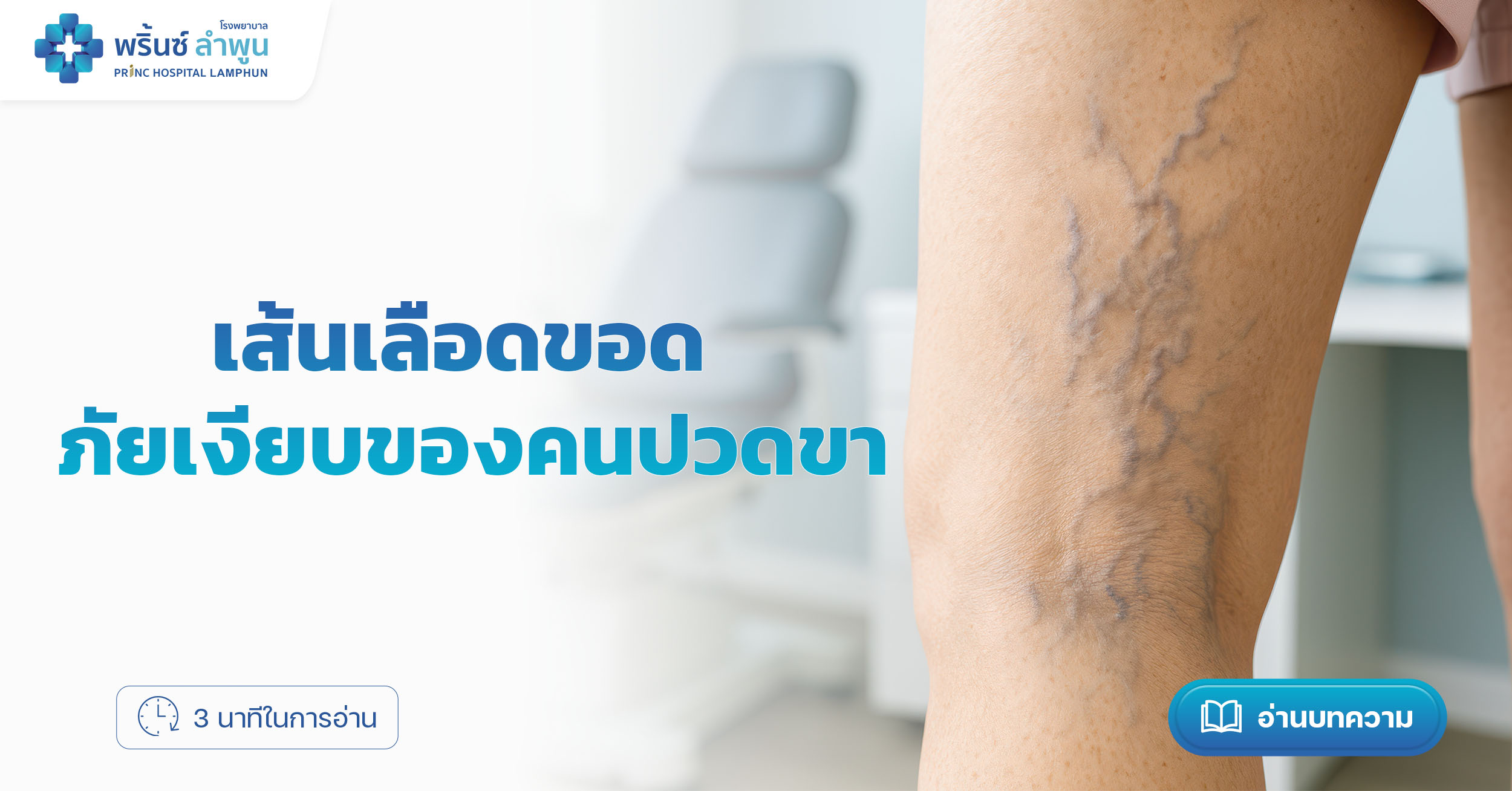 เส้นเลือดขอด ภัยเงียบของคนปวดขา