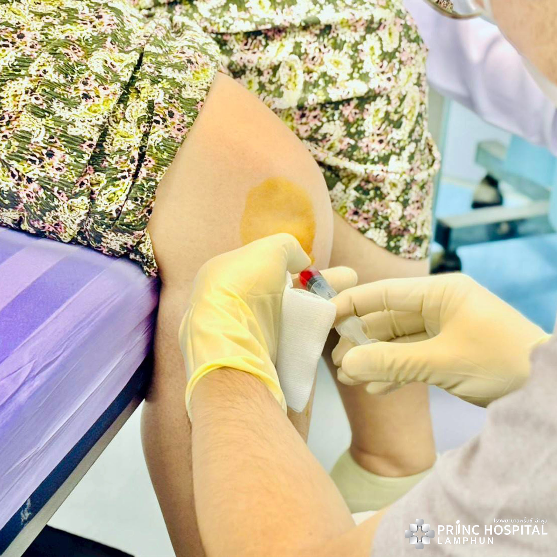 บรรยากาศทำ PRGF 1