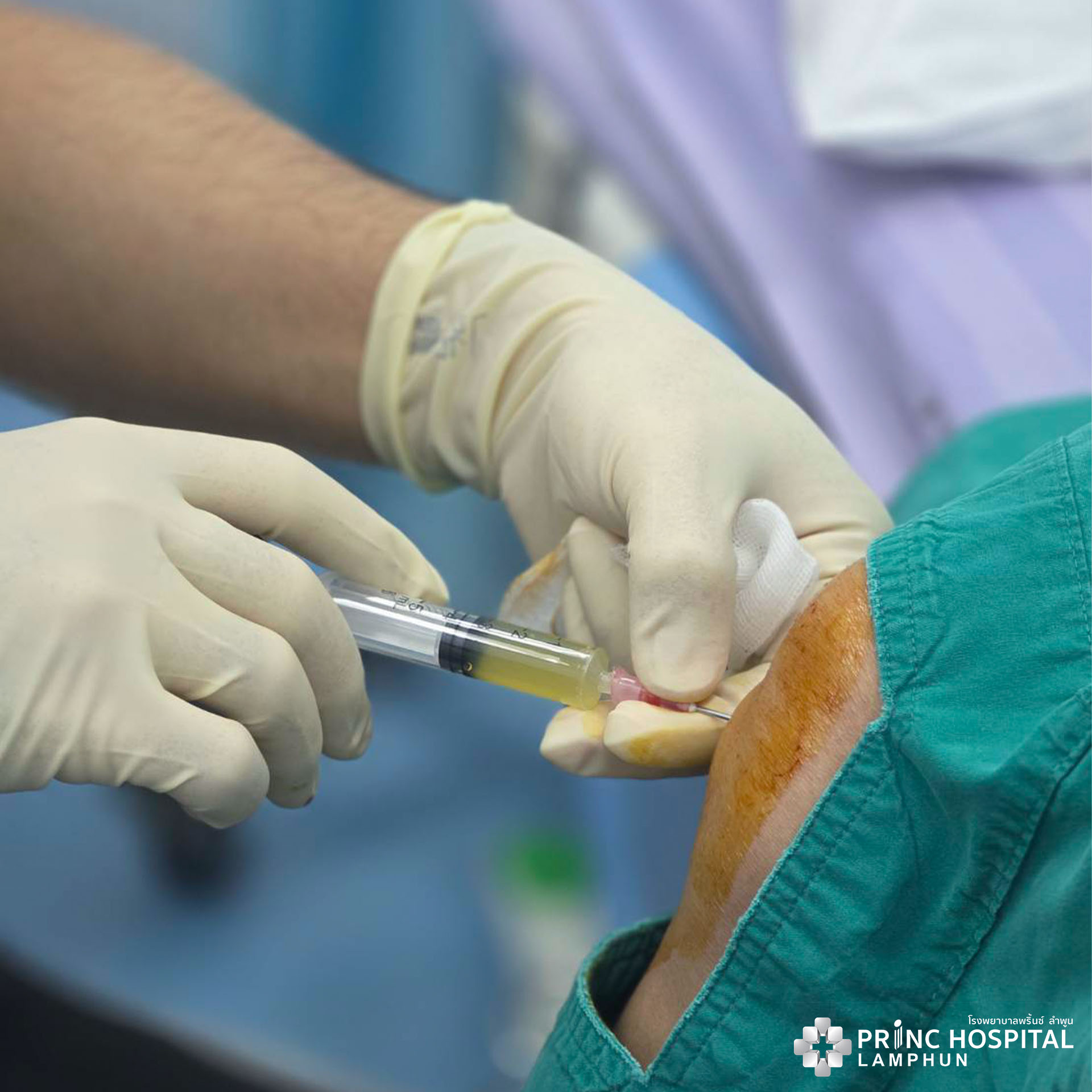 บรรยากาศทำ PRGF 2