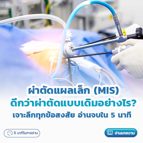 ผ่าตัดแผลเล็ก (MIS) ดีกว่าผ่าตัดแบบเดิมอย่างไร? โรงพยาบาลพริ้นซ์ ลำพูน