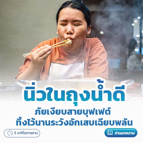 นิ่วในถุงน้ำดี: ภัยเงียบสายบุฟเฟต์ ทิ้งไว้นานระวังอักเสบเฉียบพลัน โรงพยาบาลพริ้นซ์ ลำพูน