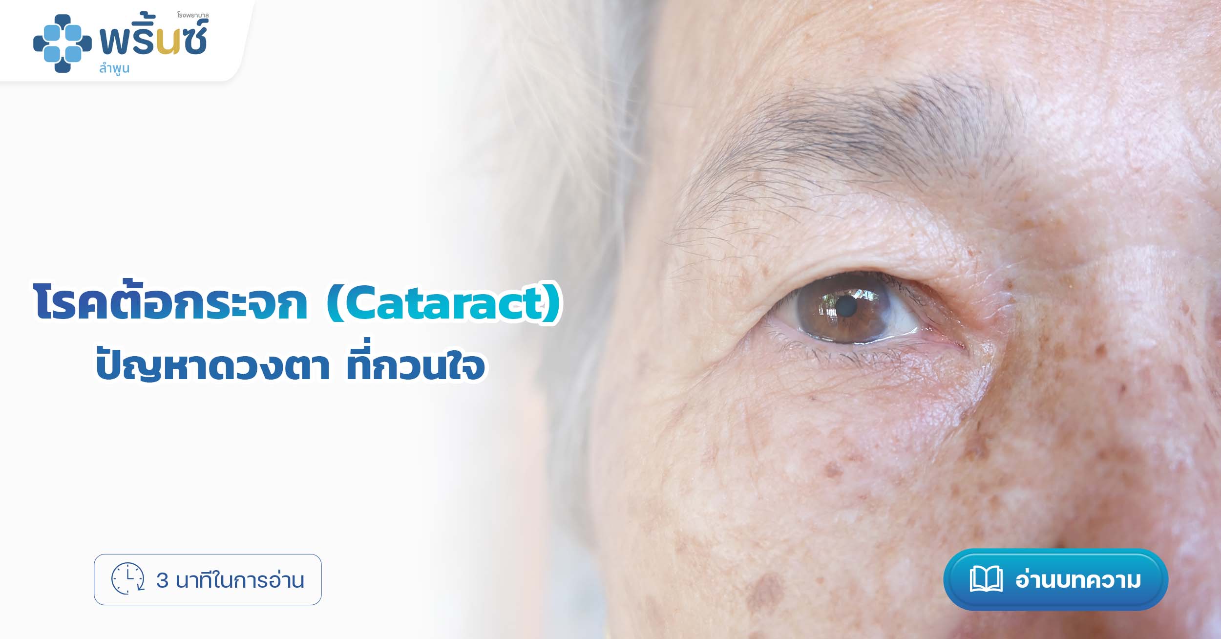 โรคต้อกระจก (Cataract) ปัญหาดวงตา ที่กวนใจ | โรงพยาบาลพริ้นซ์ ลำพูน