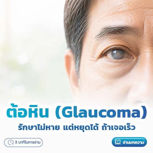 ต้อหิน (Glaucoma) รักษาไม่หาย แต่หยุดได้ ถ้าเจอเร็ว | โรงพยาบาลพริ้นซ์ ลำพูน