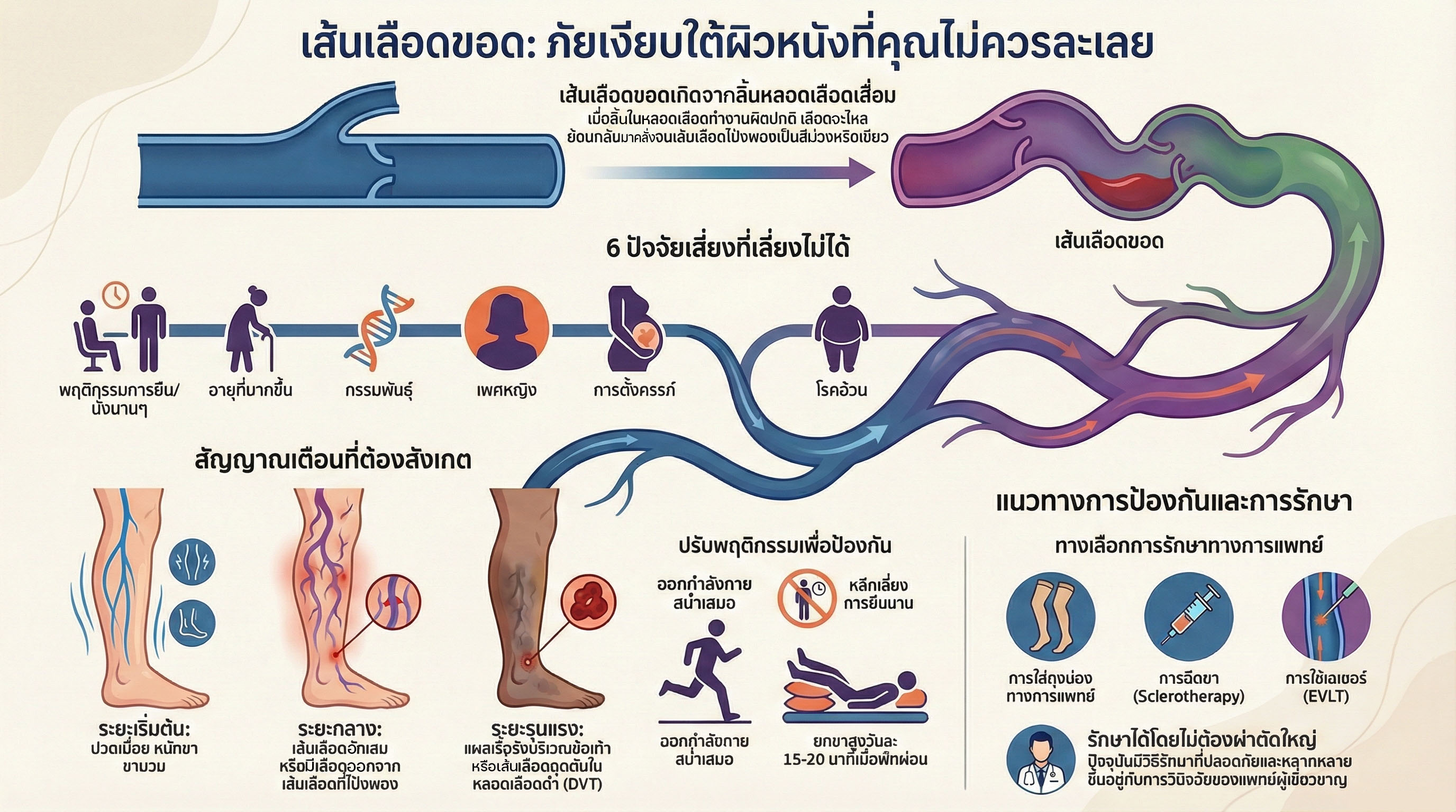 รูปภาพอธิบายเส้นเลือดขอดและลิ้นหลอดเลือด