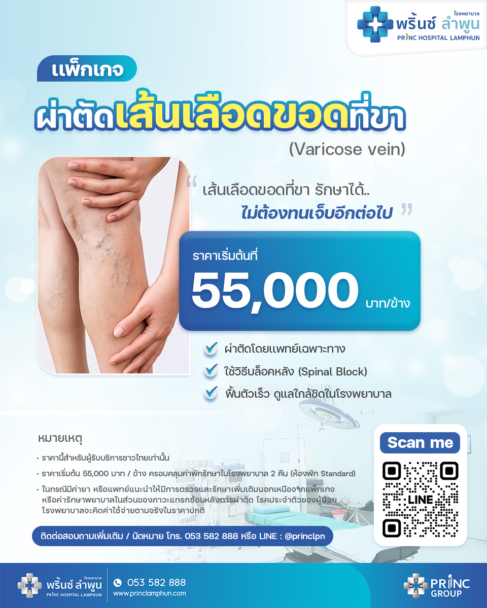 รูปแพ็กเกจเส้นเลือดขอด