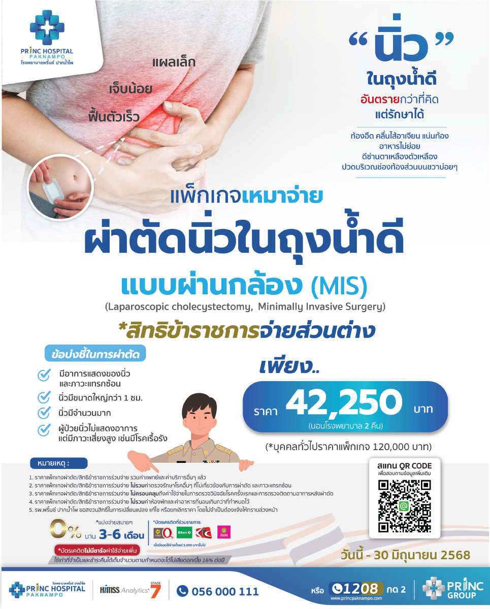 สิทธิข้าราชการ ผ่าตัดนิ่วในถุงน้ำดี(แบบผ่านกล้อง)