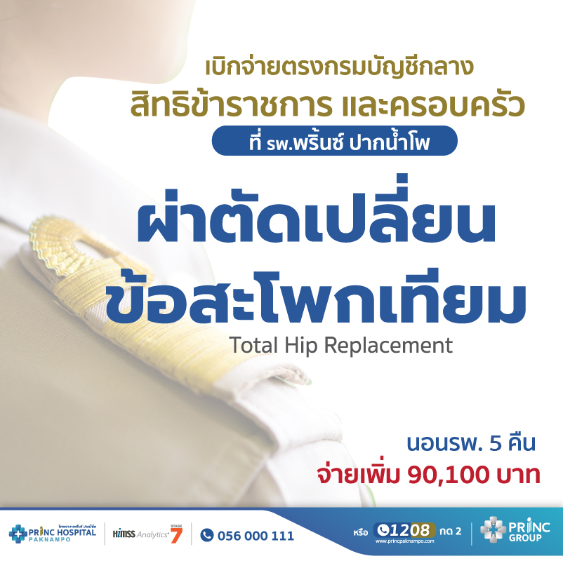 สิทธิข้าราชการ ผ่าตัดเปลี่ยนข้อสะโพก