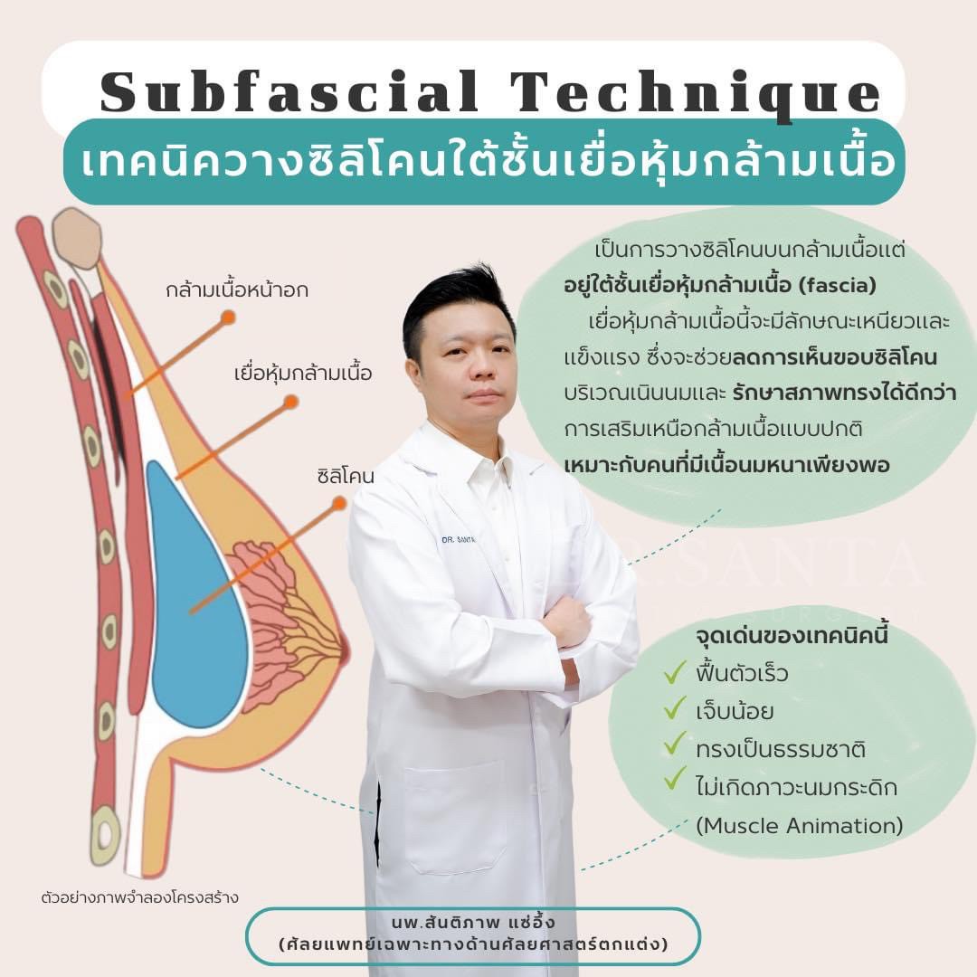 เทคนิควางซิลิโคนใต้ชั้นเยื่อหุ้มกล้ามเนื้อ