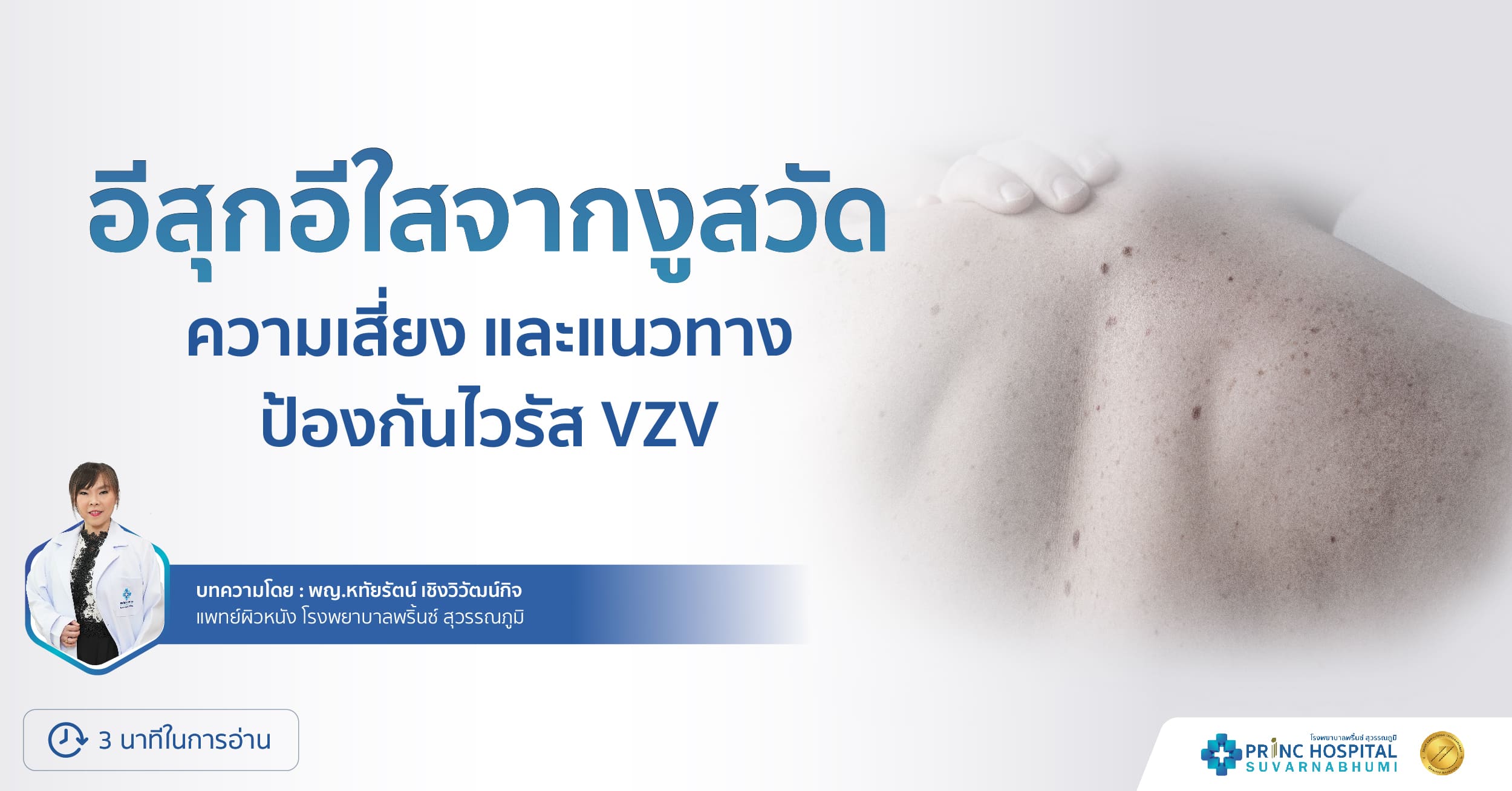 อีสุกอีใสจากงูสวัด: ความเสี่ยงและแนวทางป้องกันไวรัส VZV