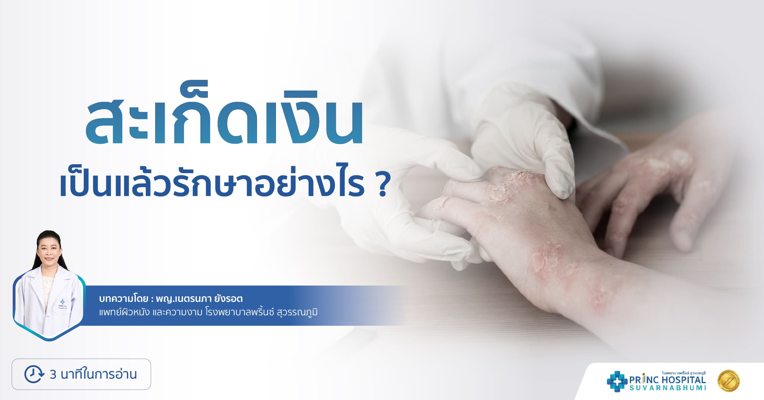 สะเก็ดเงิน เป็นแล้วรักษาอย่างไร?