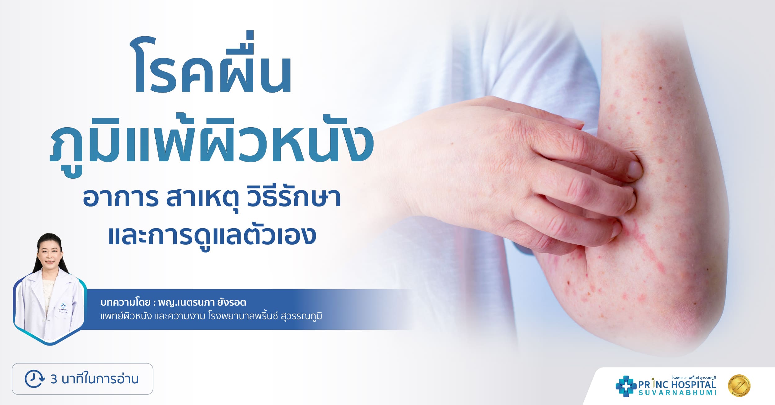 โรคผื่นภูมิแพ้ผิวหนัง  อาการ สาเหตุ วิธีรักษา และการดูแลตัวเอง