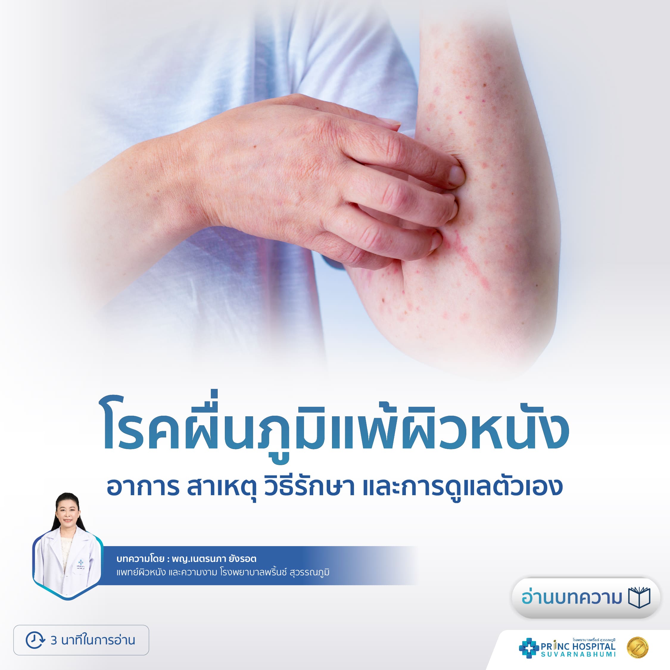 โรคผื่นภูมิแพ้ผิวหนัง  อาการ สาเหตุ วิธีรักษา และการดูแลตัวเอง