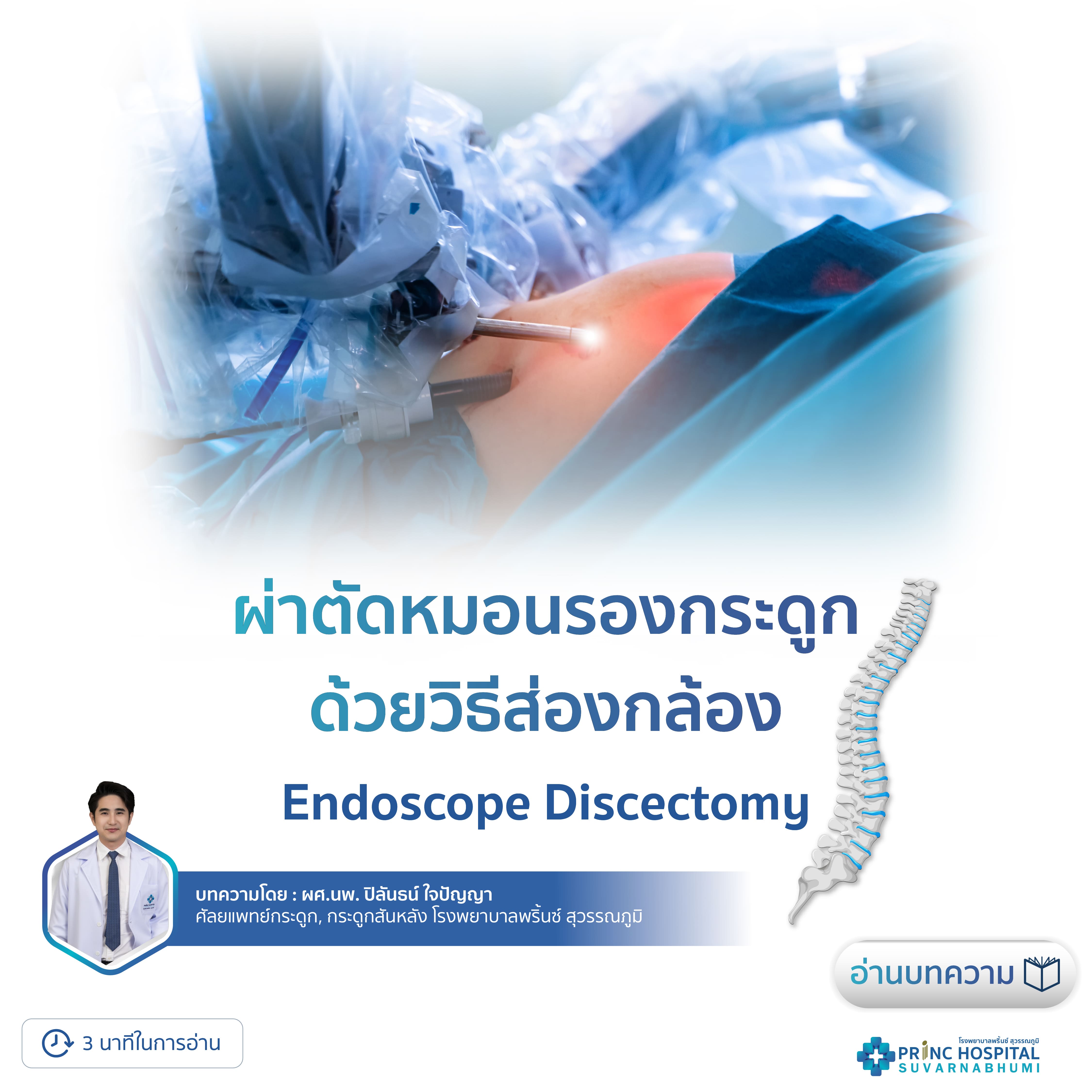 ผ่าตัดหมอนรองกระดูก-ส่องกล้อง Endoscopic Discectomy | โรงพยาบาลพริ้นซ์ สุวรรณภูมิ