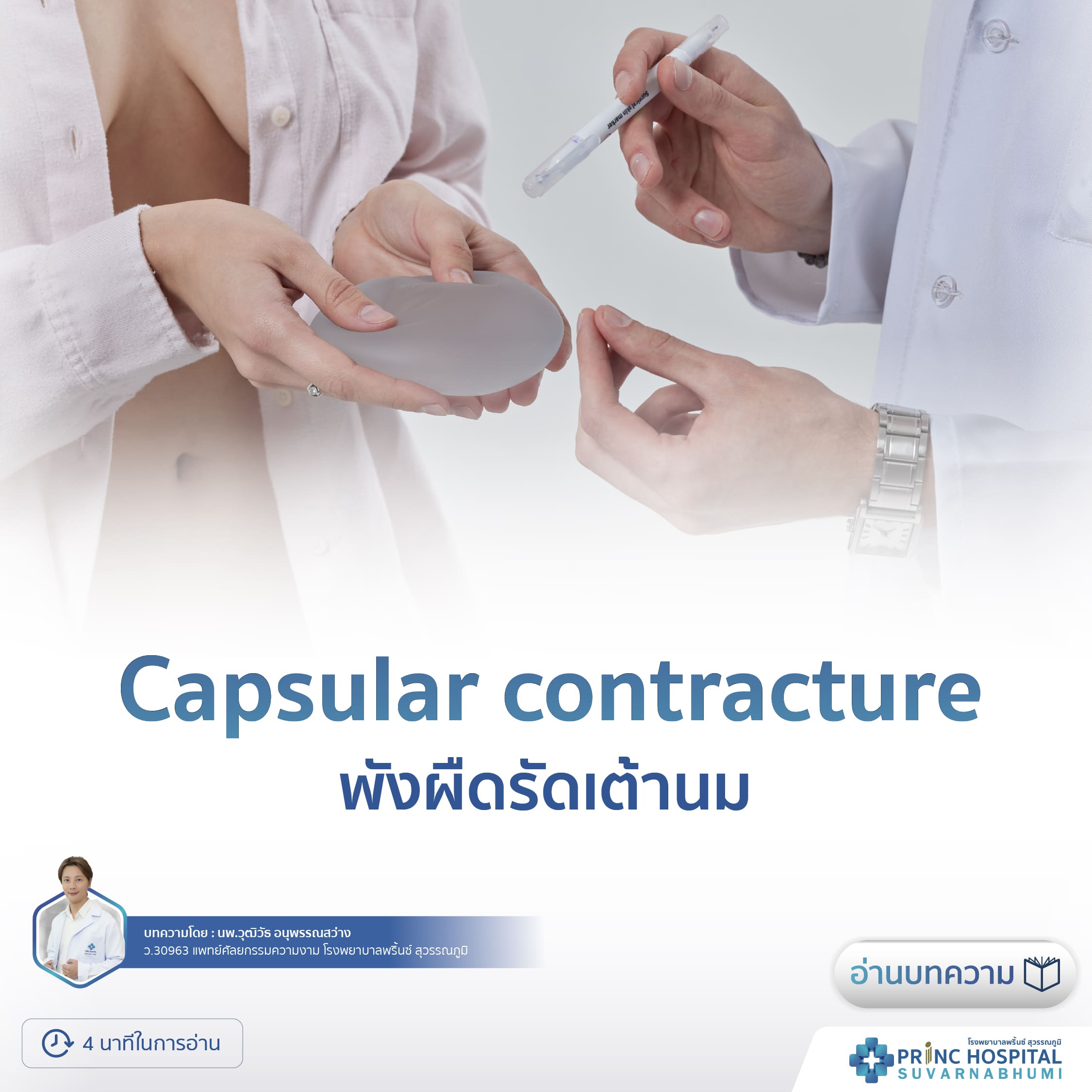 Capsular contracture พังผืดรัดเต้านม