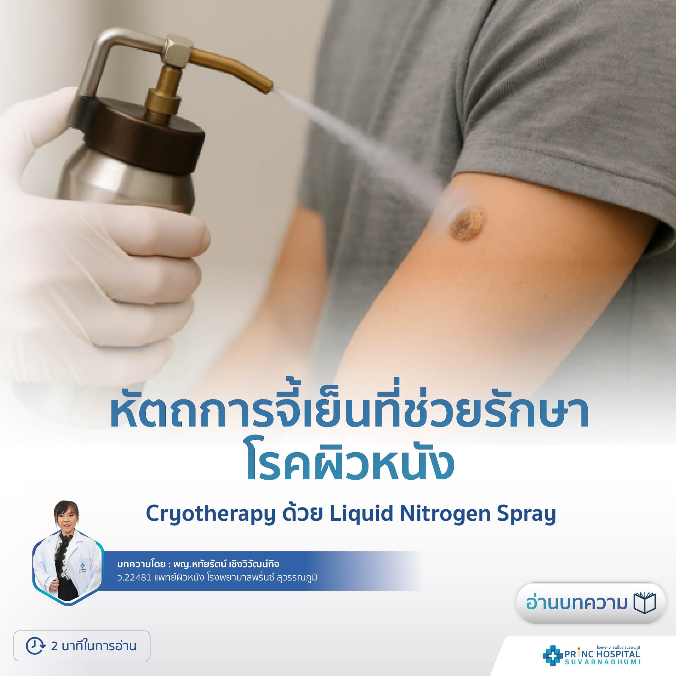 การพ่นสเปรย์ Liquid Nitrogen บนผิวหนัง