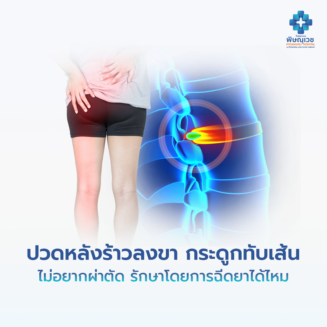 ปวดหลังไม่ผ่าตัด