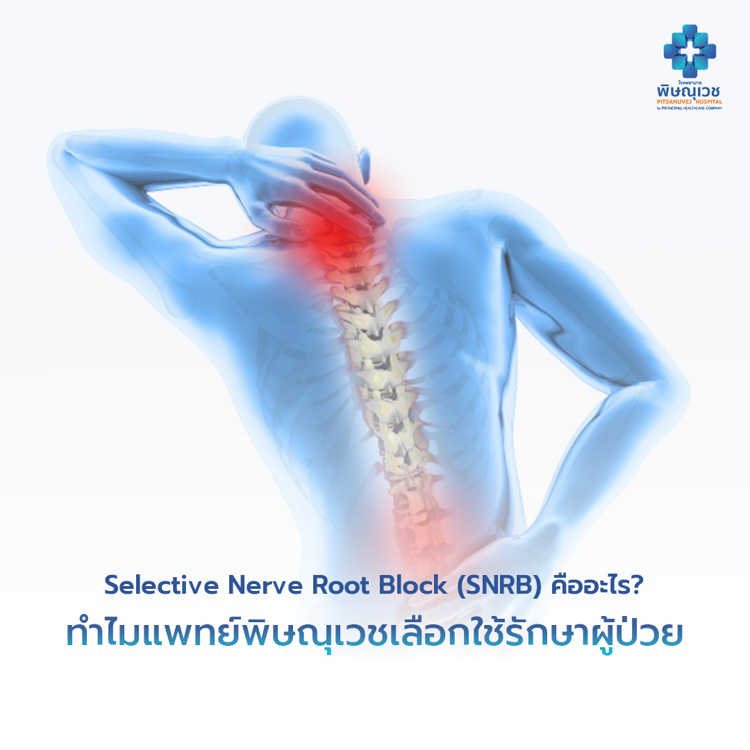 Selective Nerve Root Block (SNRB) คืออะไร? ทำไมแพทย์พิษณุเวชเลือกใช้รักษาผู้ป่วย