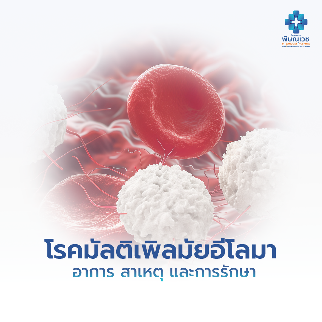 โรคมัลติเพิลมัยอีโลมา (Multiple Myeloma) | อาการ สาเหตุ และการรักษา