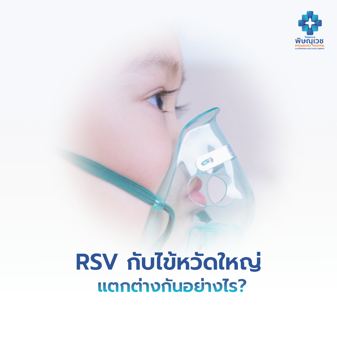 RSV กับไข้หวัดใหญ่ แตกต่างกันอย่างไร? วิเคราะห์เจาะลึกเพื่อความเข้าใจและการป้องกัน
