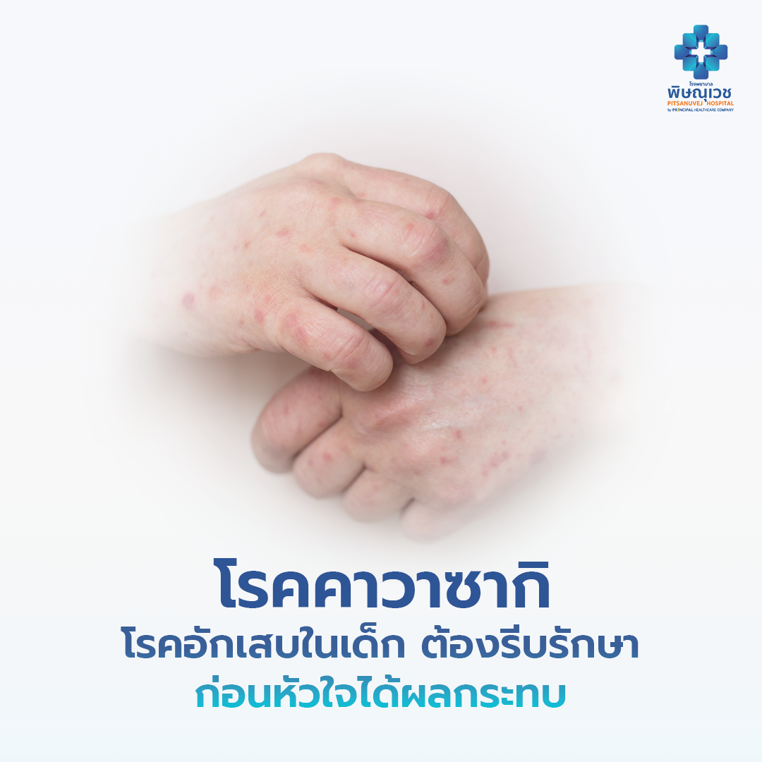 โรคคาวาซากิ โรคอักเสบในเด็กที่ต้องรีบรักษา