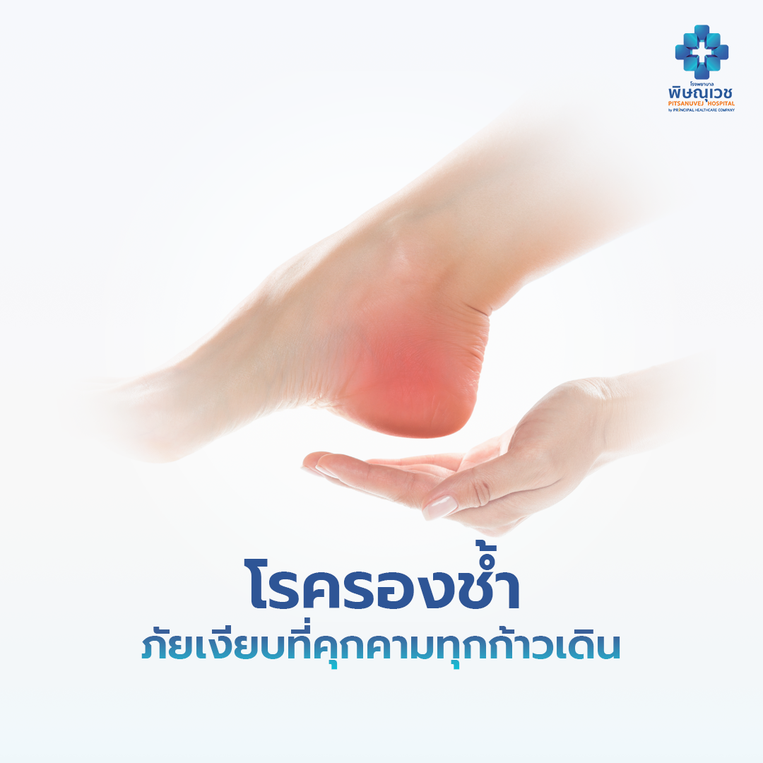 โรครองช้ำ (Plantar Fasciitis)