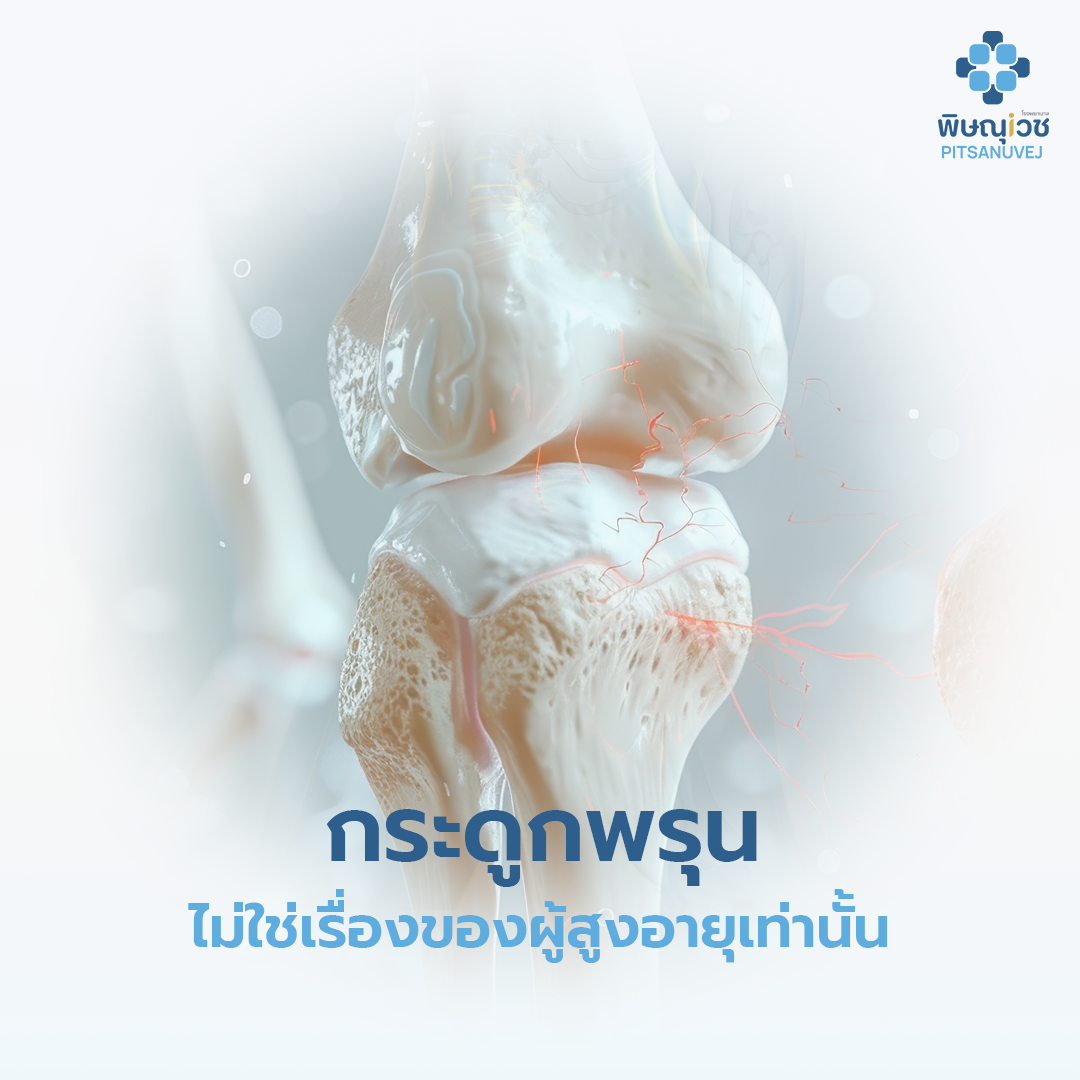 โรคกระดูกพรุนทำให้กระดูกบาง เปราะ และหักง่าย