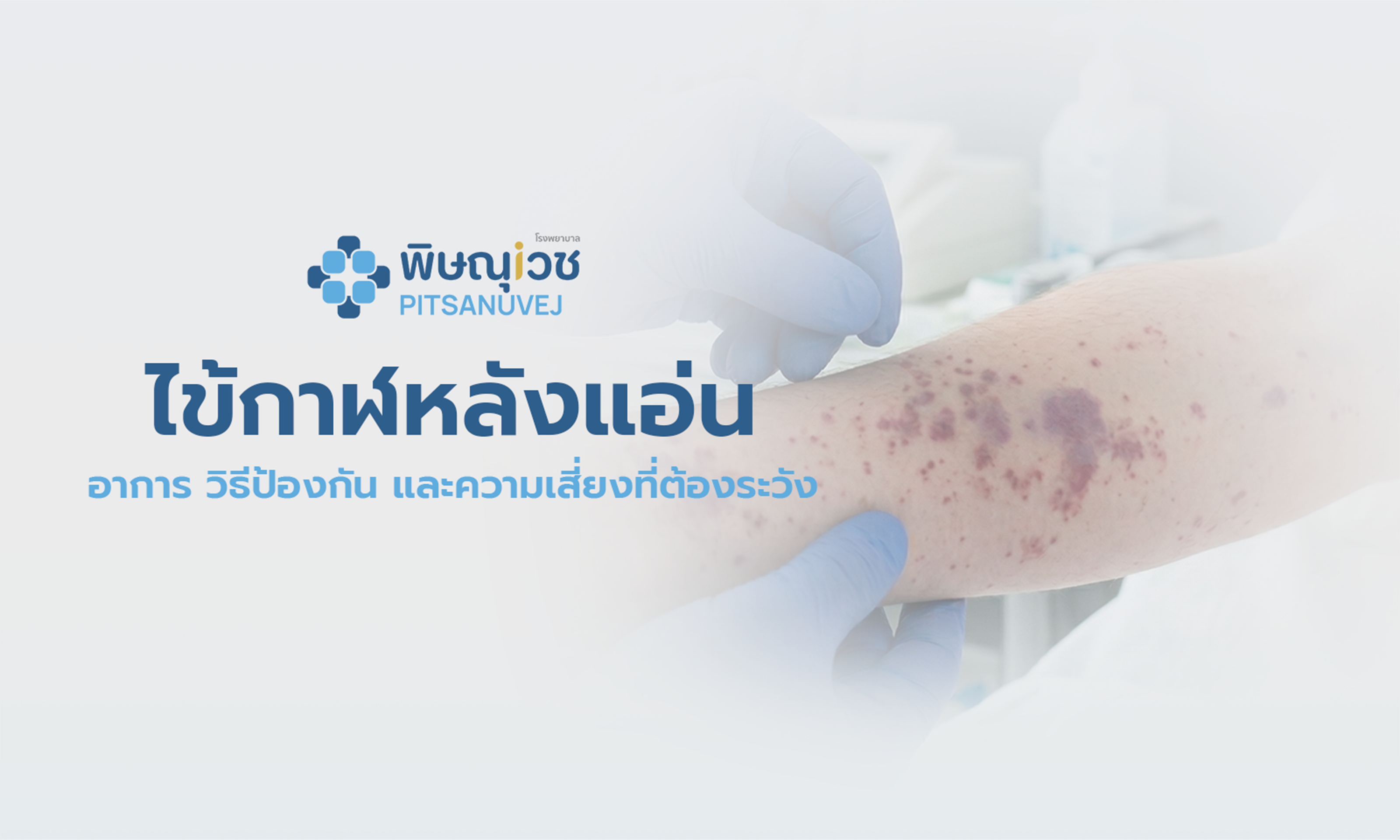 ไข้กาฬหลังแอ่น 2569  เช็กอาการ Red Flags และวิธีป้องกันที่ควรรู้