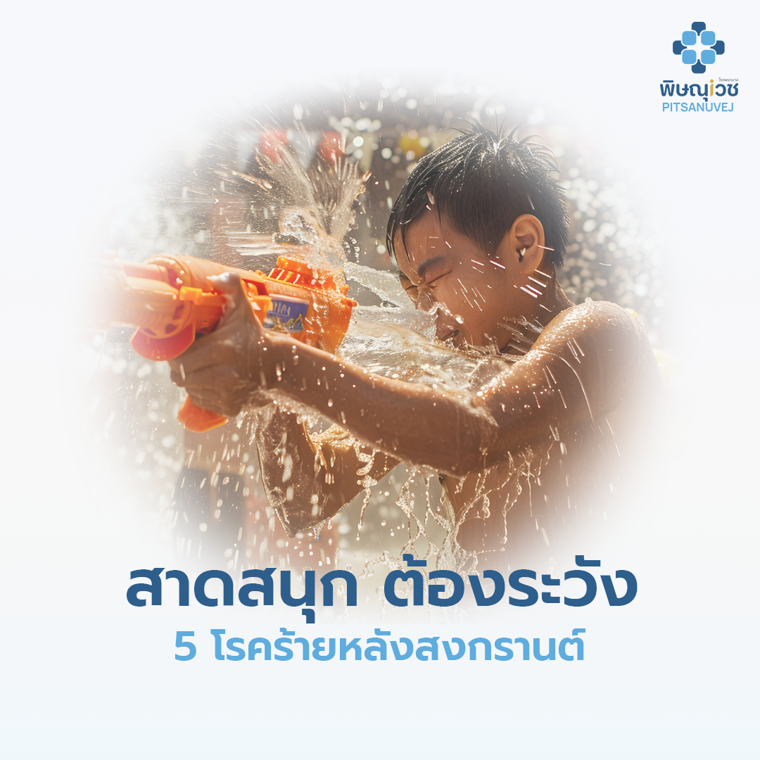 5 โรคช่วงสงกรานต์ ที่ต้องระวัง