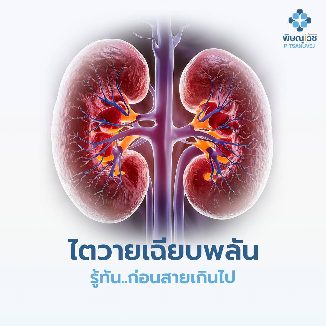 ไตวายเฉียบพลัน (Acute Kidney Injury) รู้ทันก่อนสายเกินไป