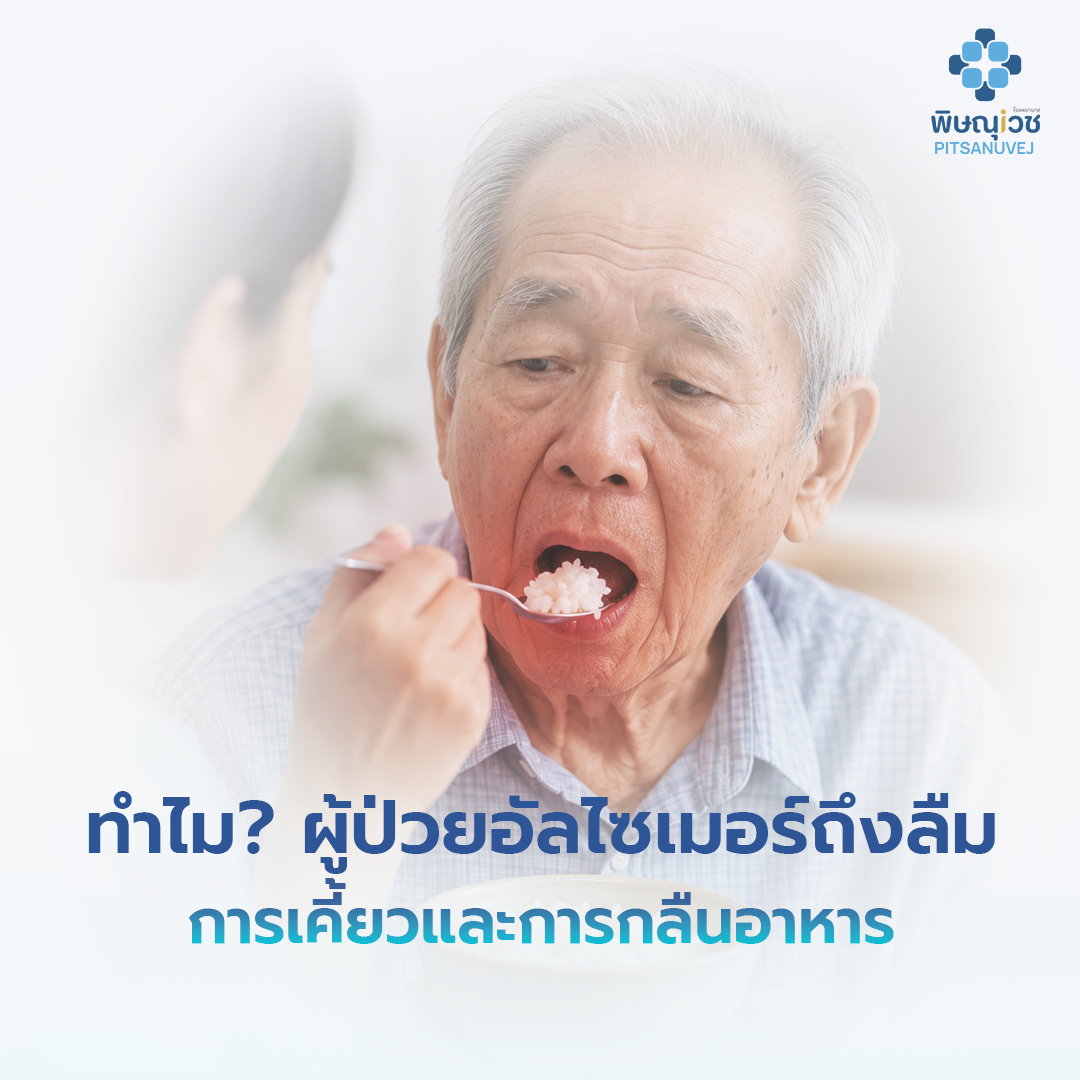 ผู้ป่วยอัลไซเมอร์มีภาวะกลืนลำบากระหว่างรับประทานอาหาร