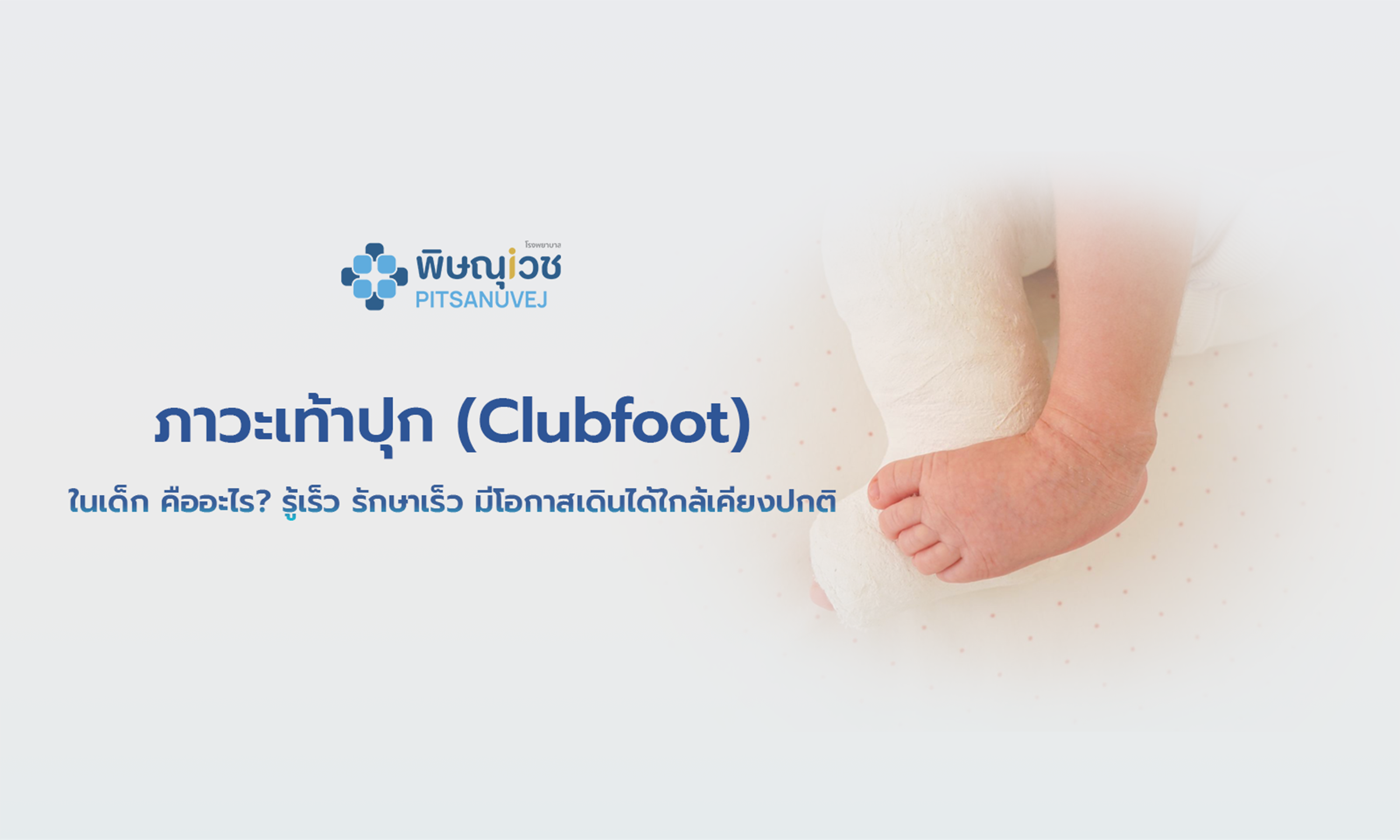 ลักษณะเท้าปุก Clubfoot ในเด็ก เท้าบิดเข้าด้านในและปลายเท้าชี้ลง