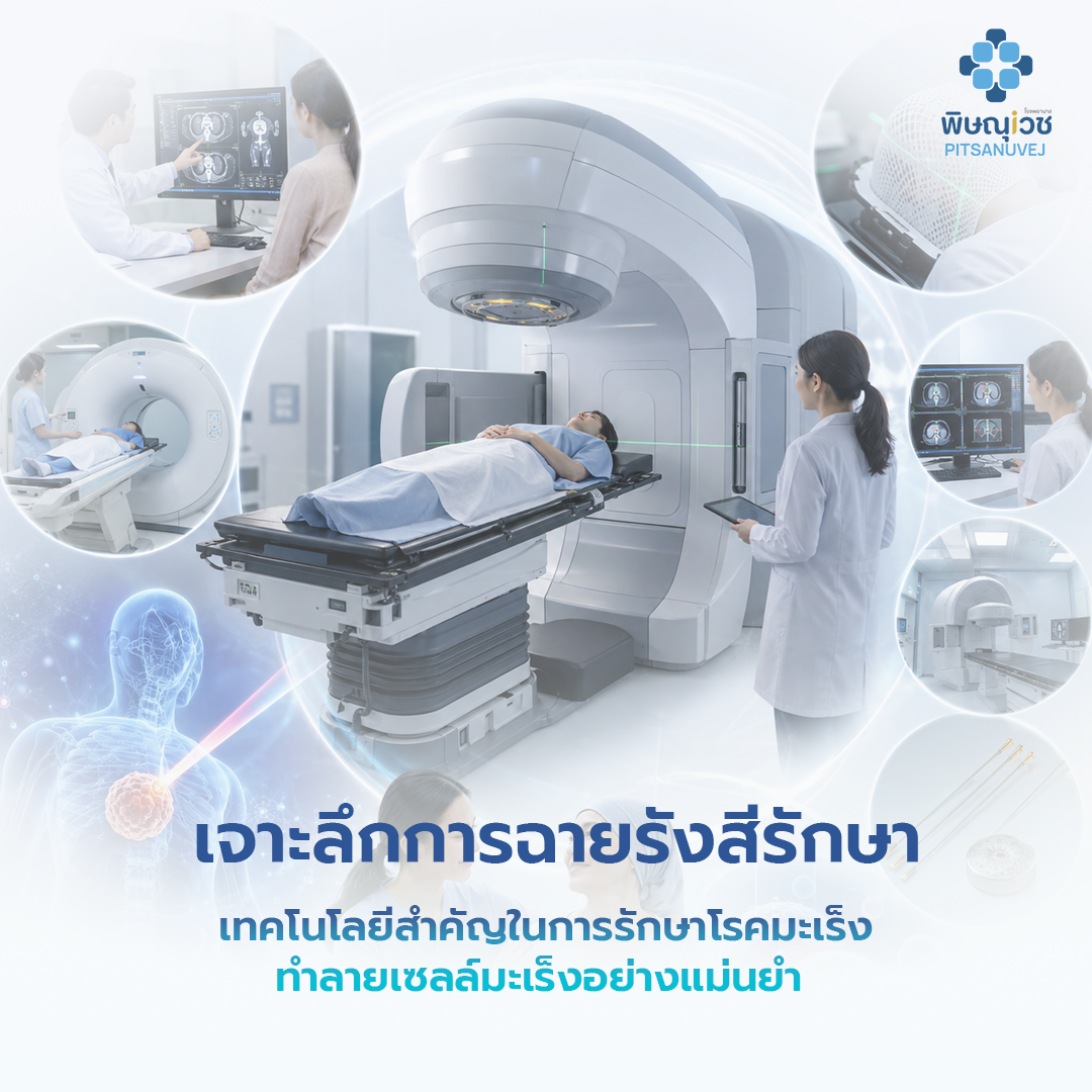 แพทย์รังสีรักษาวางแผนการฉายรังสีรักษามะเร็งด้วยเครื่อง LINAC เพื่อทำลายเซลล์มะเร็งอย่างแม่นยำ