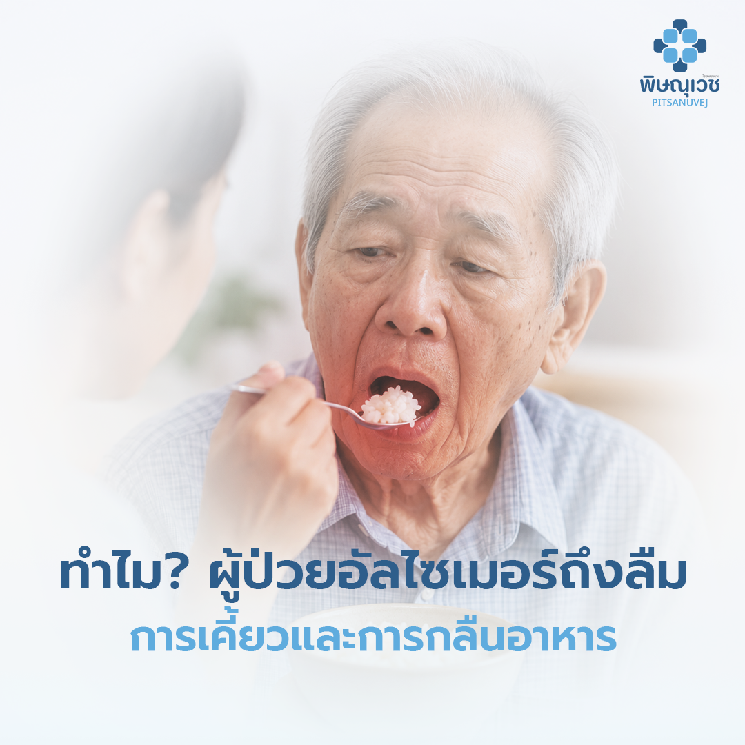 ผู้ป่วยอัลไซเมอร์มีภาวะกลืนลำบากระหว่างรับประทานอาหาร