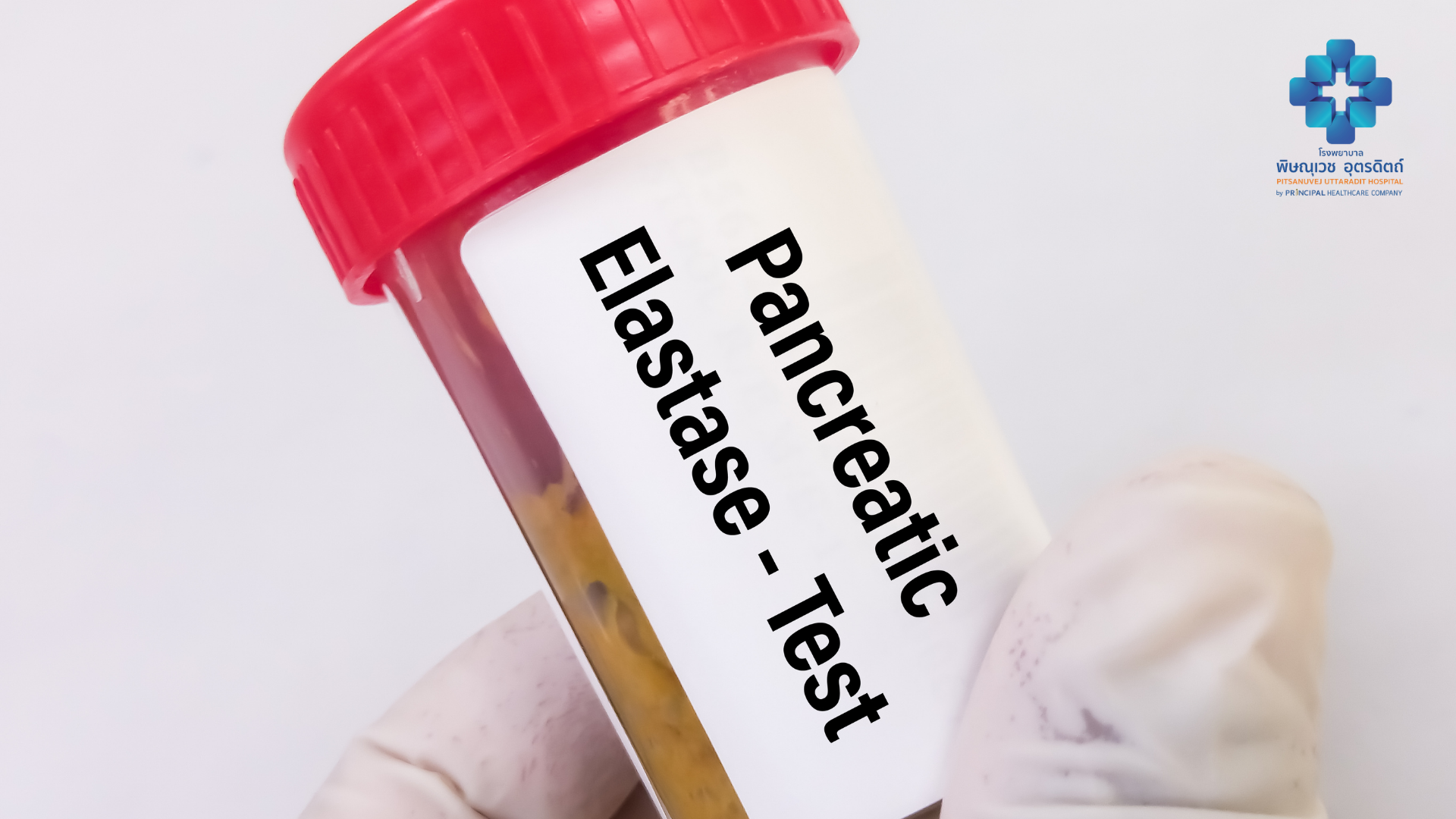 การตรวจวิเคราะห์อุจจาระ