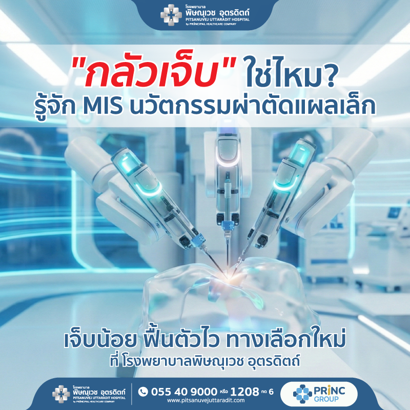 "กลัวเจ็บ" ใช่ไหม? รู้จัก MIS นวัตกรรมผ่าตัดแผลเล็ก เจ็บน้อย ฟื้นตัวไว ทางเลือกใหม่ที่โรงพยาบาลพิษณุเวช อุตรดิตถ์